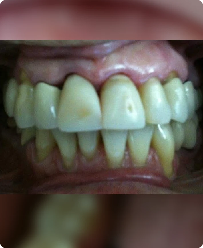 Depois